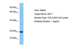 Adenine Nucleotide Translocase 1 Rabbit anti-Human, Polyclonal, Novus Biologicals